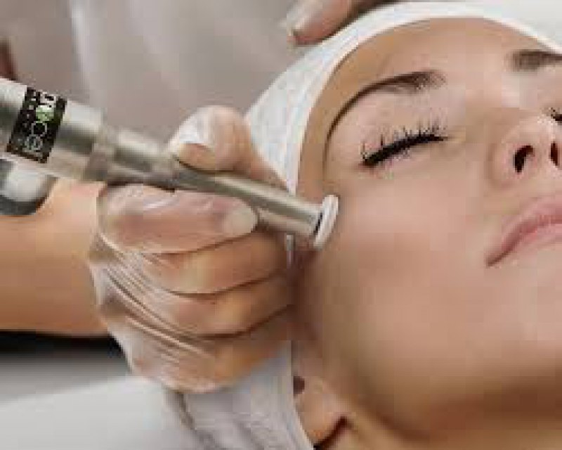 ****Microchannelling rejuvenation ****