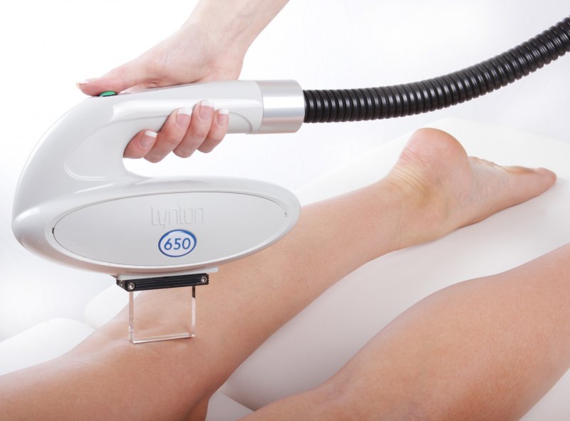 6 x IPL Hollywood hair removal