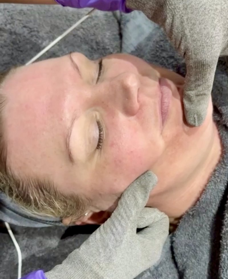 Icon Platinum Touch: Signature Lift x 7 Treatments