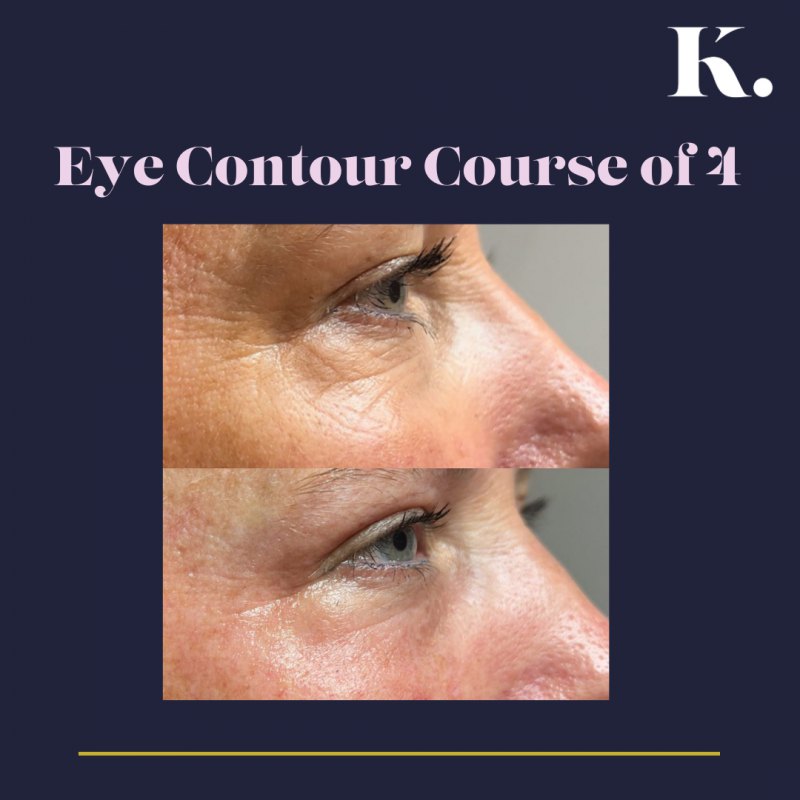 Eye Contour Course of 4