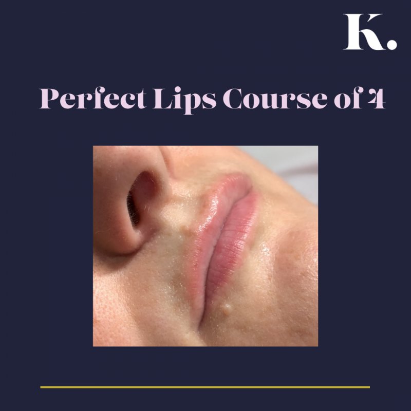 Perfect lips Course of 4